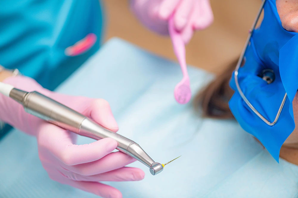 Endodonție – Tratamente de Canal Precise