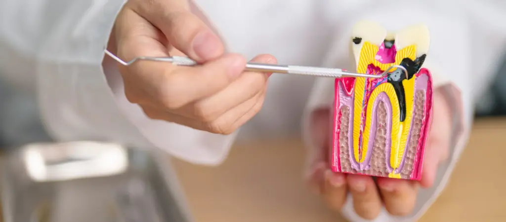 Endodonție sector 3 - Dental Planet