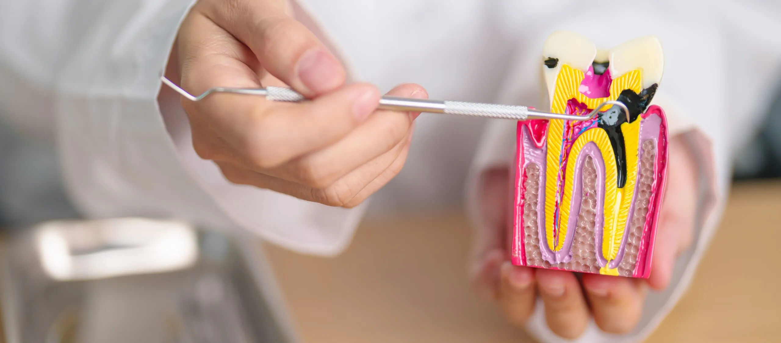 Endodonție sector 3 - Dental Planet