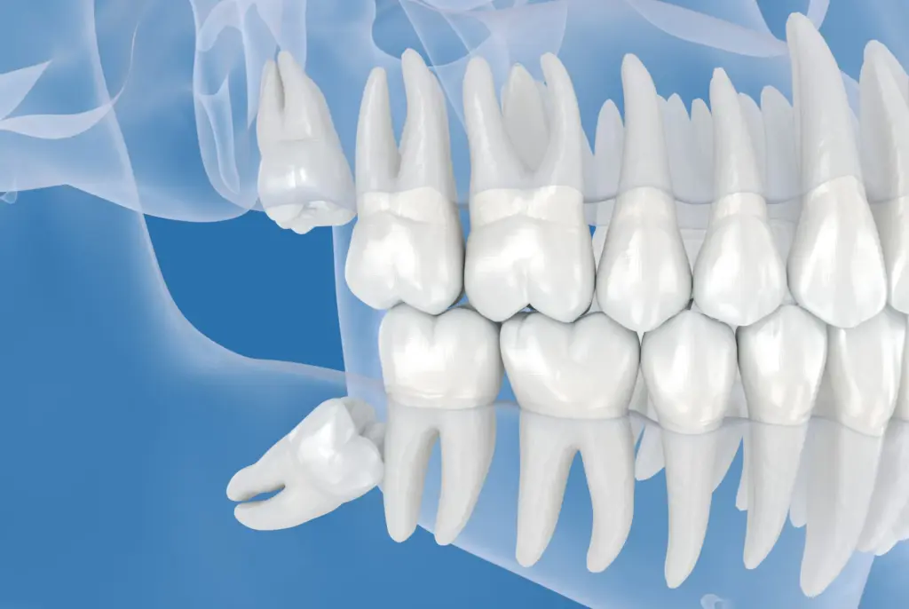 Chirurgie dentară sector 3 - Dental Planet