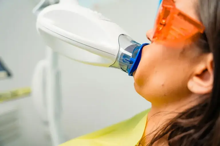 Lampă albire Philips Zoom — Dental Planet