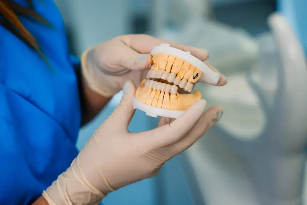 coroana pe implant - model de arcada cu bonturi, in cabinetul Dental Planet