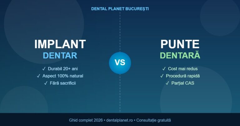Implant Dentar vs. Punte Dentară: Ce Alegi în 2026?