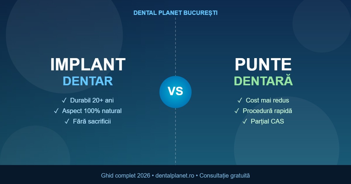 Implant dentar vs punte dentară – comparație completă 2026 la Dental Planet București