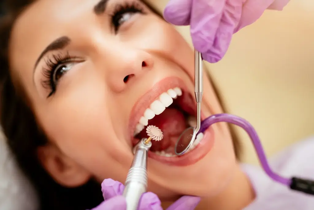 detartraj dentar - igienizare profesionala la Dental Planet