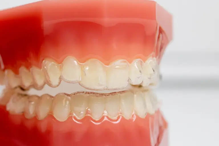 Spark vs. Invisalign: ce alegi în 2026?