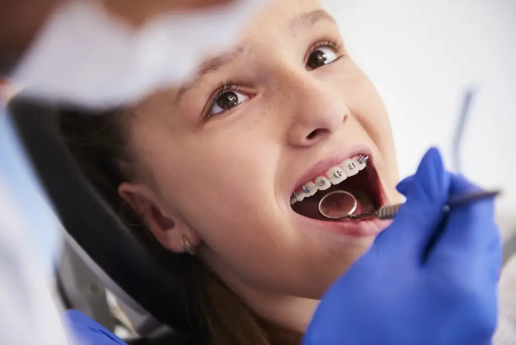 aparat dentar copii - control ortodontic la Dental Planet