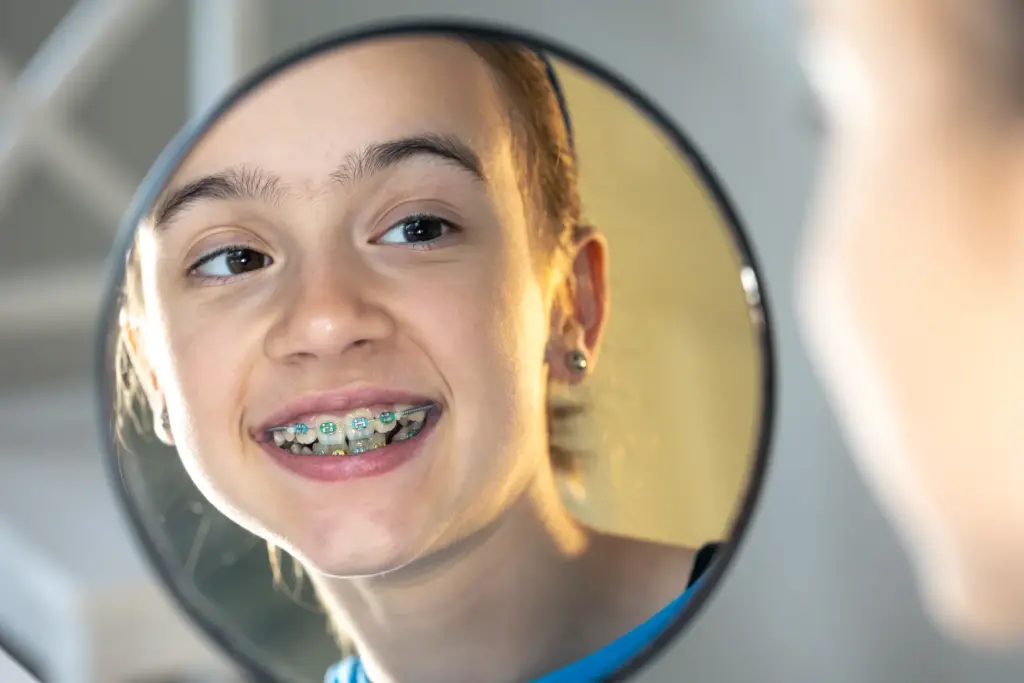 aparat dentar fix - rezultat la adolescenti la Dental Planet