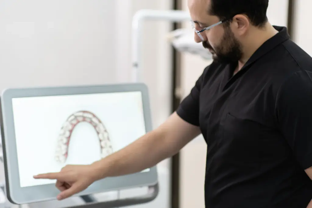 aparat dentar invizibil - planificare digitala pe modele de arcada la Dental Planet