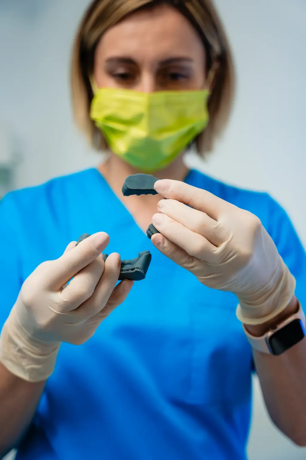 Modele printate 3D folosite la planificarea fațetelor dentare