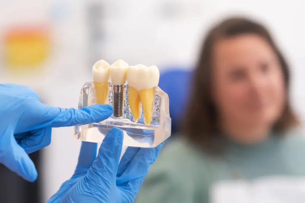 implant dentar Straumann - medic explica sistemul pe model la Dental Planet