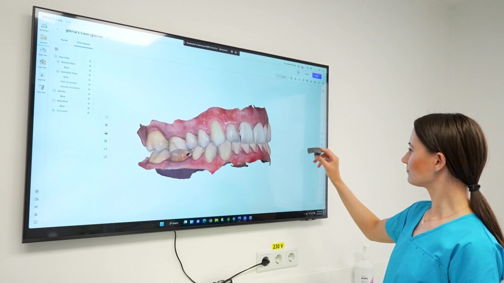 Scanare intraorală 3D afișată pe ecran mare în cabinetul Dental Planet din Baba Novac